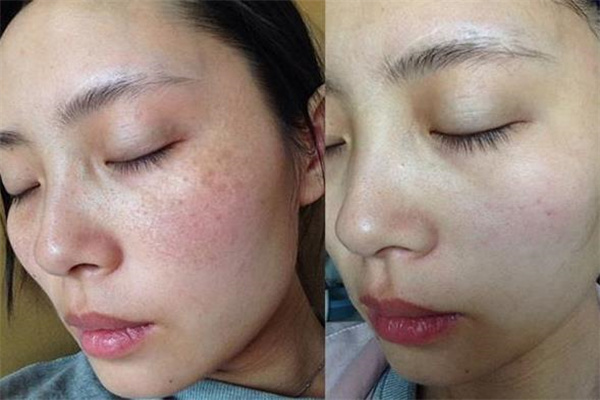 芙博莱美容加盟