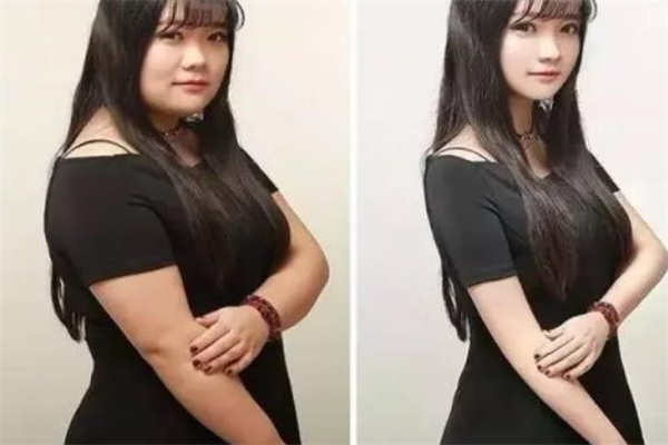 天美瘦身